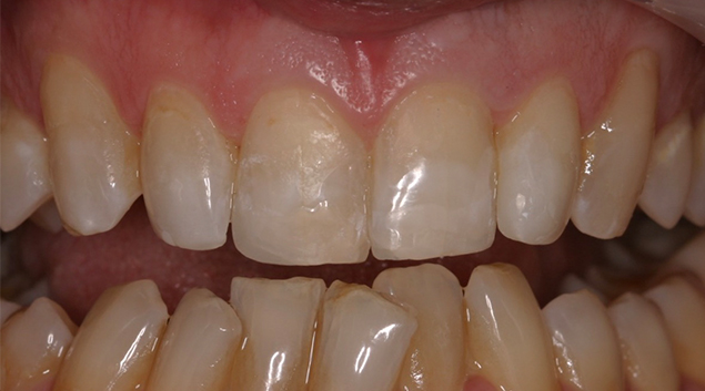 After - Dr Kit Spears