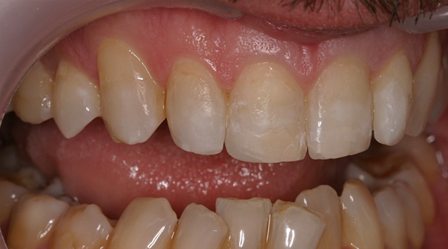 After - Dr Kit Spears