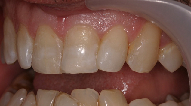 After - Dr Kit Spears