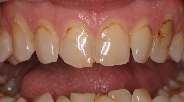 Before - Dr Kit Spears