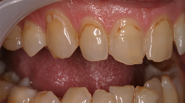 Before - Dr Kit Spears