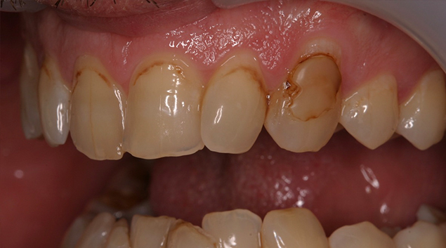 Before - Dr Kit Spears