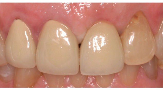 After - Dr Kit Spears