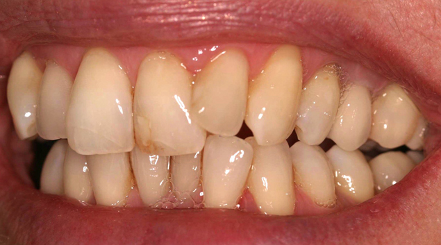 After - Dr Kit Spears