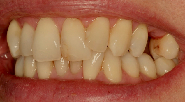 Before - Dr Kit Spears