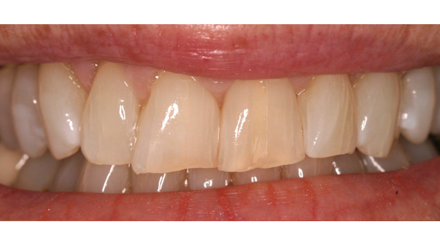 After - Dr Kit Spears