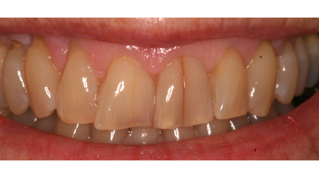 Before - Dr Kit Spears