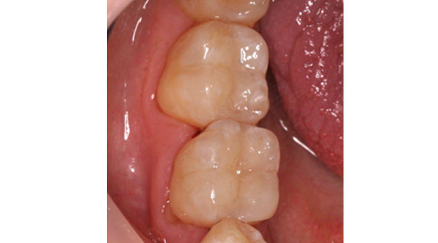 After - Dr Kit Spears