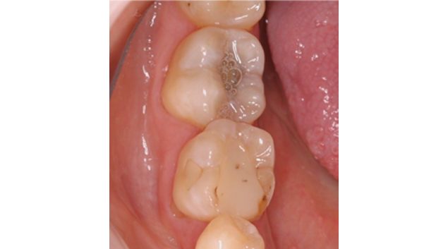 Before - Dr Kit Spears