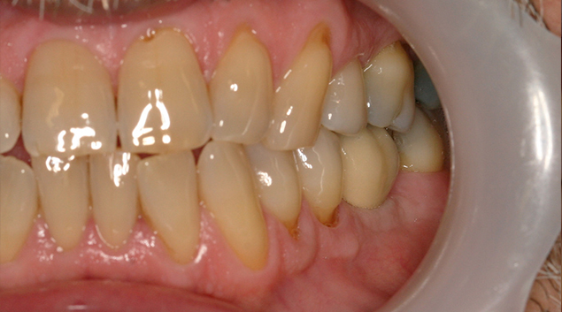 After - Dr Kit Spears