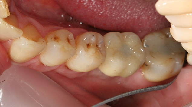 After - Dr Kit Spears