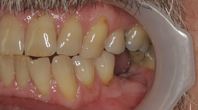 Before - Dr Kit Spears