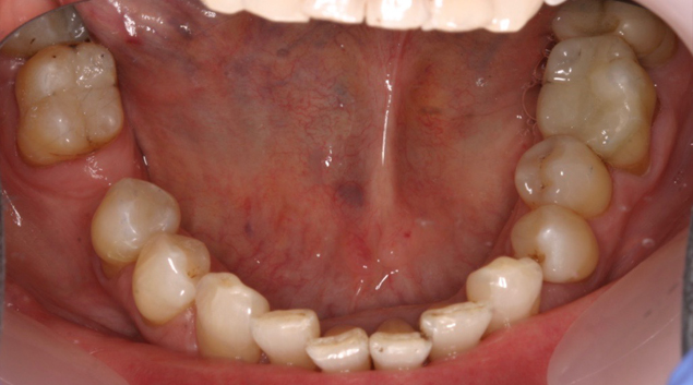 After - Dr Kit Spears