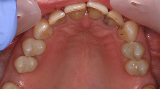 After - Dr Kit Spears