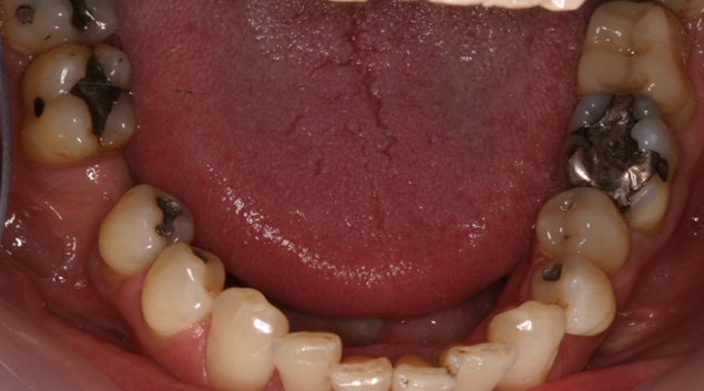 Before - Dr Kit Spears