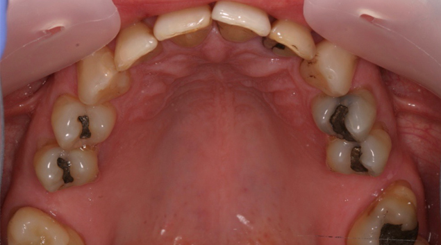 Before - Dr Kit Spears