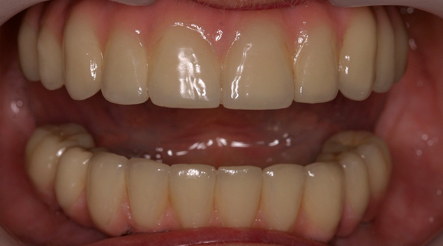 After - Dr Kit Spears