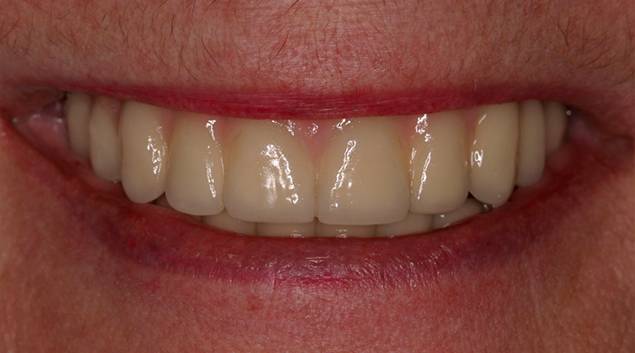After - Dr Kit Spears