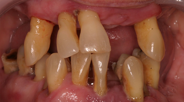 Before - Dr Kit Spears