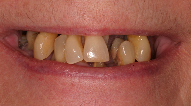 Before - Dr Kit Spears