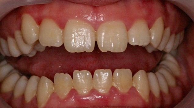 Before - Dr Kit Spears