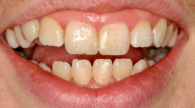 After - Dr Kit Spears