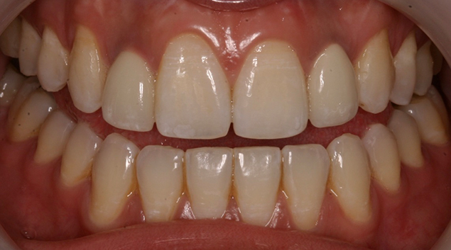 After - Dr Kit Spears