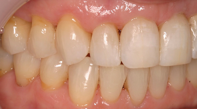 After - Dr Kit Spears