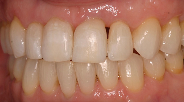 After - Dr Kit Spears