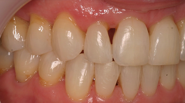 Before - Dr Kit Spears