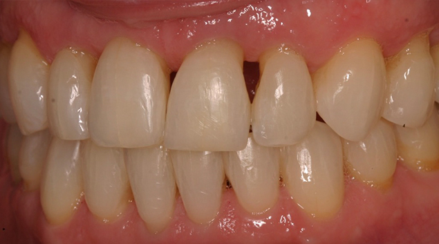 Before - Dr Kit Spears