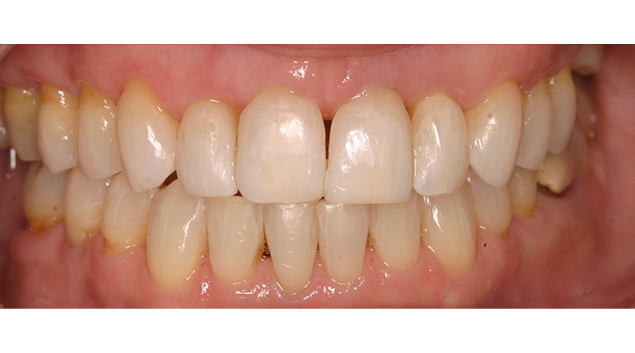 After - Dr Kit Spears