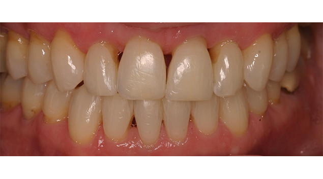 Before - Dr Kit Spears