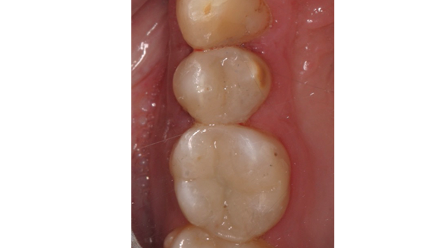 After - Dr Kit Spears