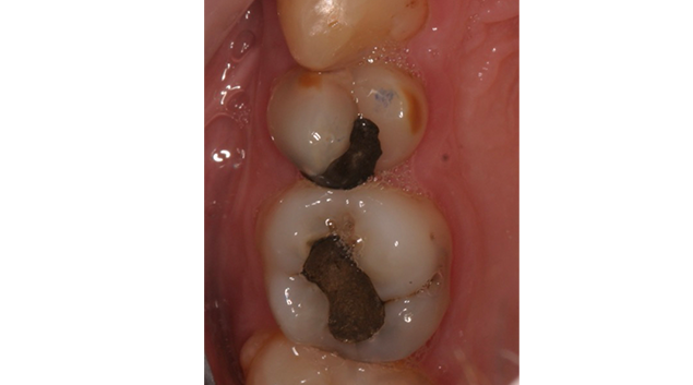 Before - Dr Kit Spears