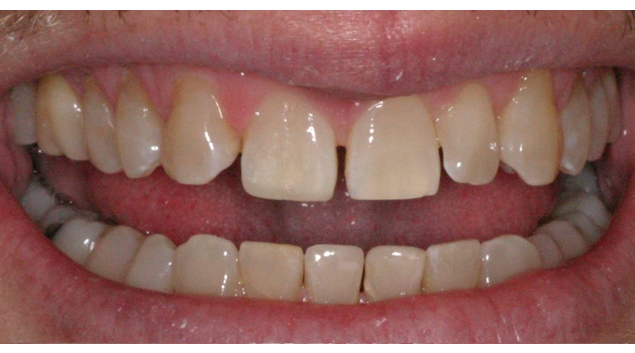 After - Dr Kit Spears