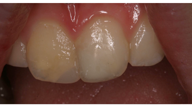 After - Dr Kit Spears