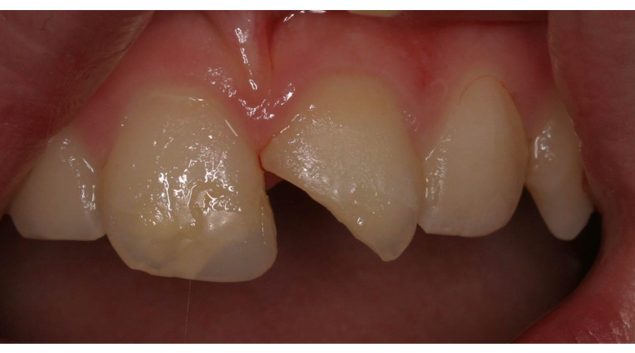 Before - Dr Kit Spears