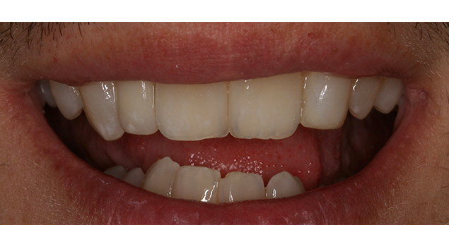 After - Dr Kit Spears