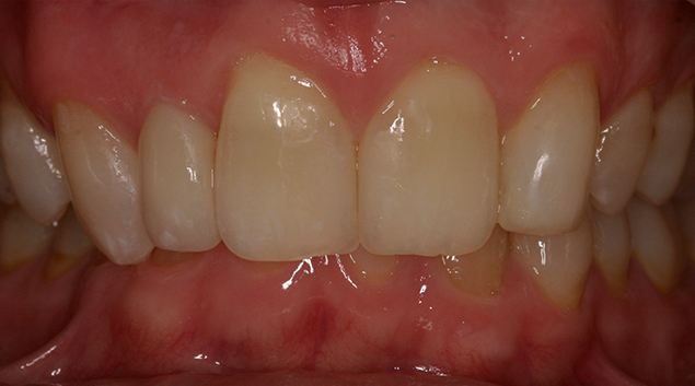 After - Dr Kit Spears