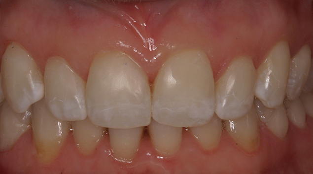 After - Dr Kit Spears