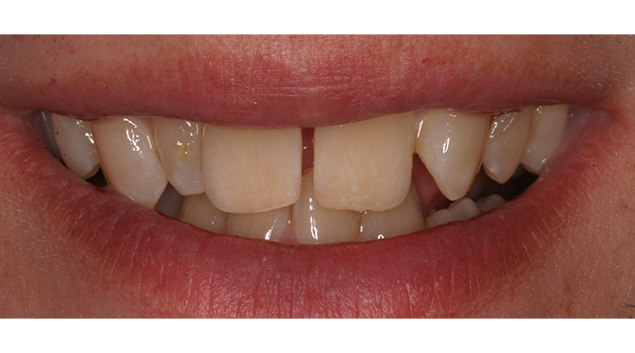 Before - Dr Kit Spears