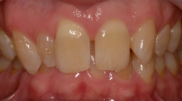 Before - Dr Kit Spears