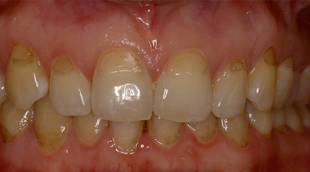 Before - Dr Kit Spears
